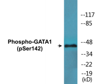 Phospho-GATA1 (Ser142) Colorimetric Cell-Based ELISA Kit