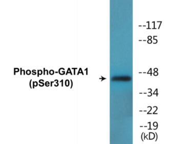 Phospho-GATA1 (Ser310) Colorimetric Cell-Based ELISA Kit