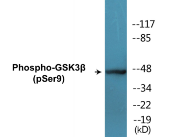 Phospho-GSK3beta (Ser9) Colorimetric Cell-Based ELISA Kit