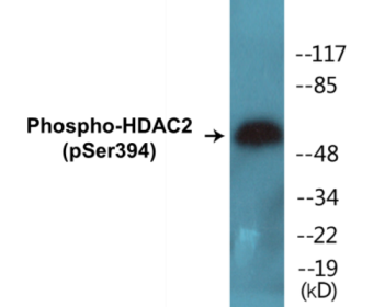 Phospho-HDAC2 (Ser394) Colorimetric Cell-Based ELISA Kit