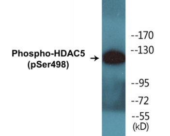 Phospho-HDAC5 (Ser498) Colorimetric Cell-Based ELISA Kit