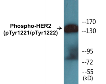 Phospho-HER2 (Tyr1221/Tyr1222) Colorimetric Cell-Based ELISA Kit