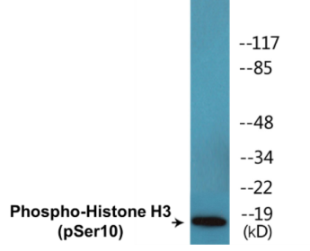 Phospho-Histone H3 (Ser10) Colorimetric Cell-Based ELISA Kit