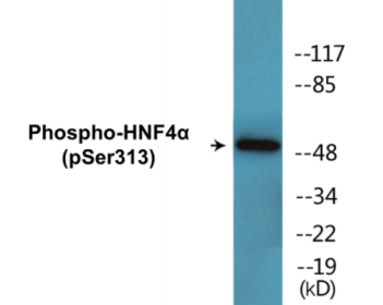 Phospho-HNF4alpha (Ser313) Colorimetric Cell-Based ELISA Kit