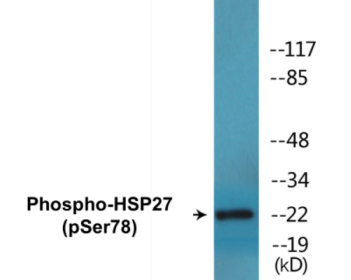 Phospho-HSP27 (Ser78) Colorimetric Cell-Based ELISA Kit