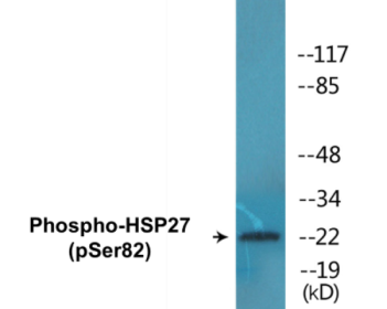 Phospho-HSP27 (Ser82) Colorimetric Cell-Based ELISA Kit