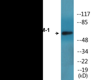 Phospho-ICAM-1 (Tyr512) Colorimetric Cell-Based ELISA Kit