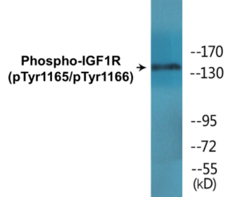 Phospho-IGF1R (Tyr1165/Tyr1166) Colorimetric Cell-Based ELISA Kit