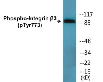 Phospho-Integrin beta3 (Tyr773) Colorimetric Cell-Based ELISA Kit