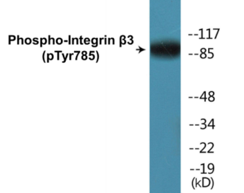Phospho-Integrin beta3 (Tyr785) Colorimetric Cell-Based ELISA Kit