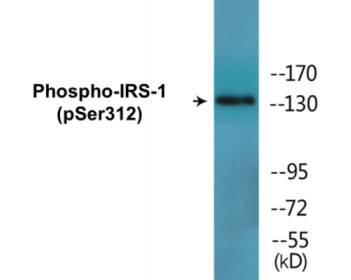 Phospho-IRS-1 (Ser312) Colorimetric Cell-Based ELISA Kit