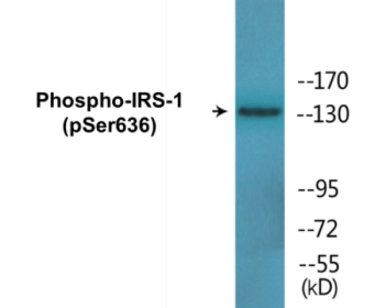Phospho-IRS-1 (Ser636) Colorimetric Cell-Based ELISA Kit