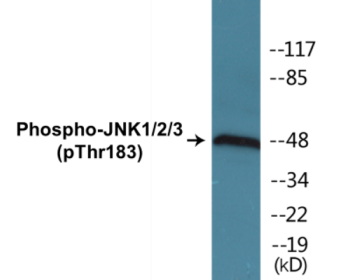 Phospho-JNK1/2/3 (Thr183) Colorimetric Cell-Based ELISA Kit