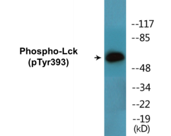 Phospho-Lck (Tyr393) Colorimetric Cell-Based ELISA Kit