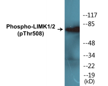 Phospho-LIMK1/2 (Thr508) Colorimetric Cell-Based ELISA Kit