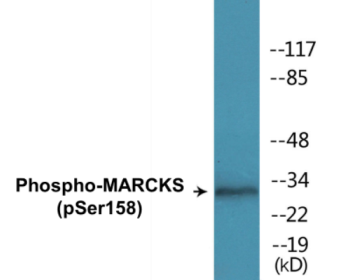 Phospho-MARCKS (Ser158) Colorimetric Cell-Based ELISA Kit