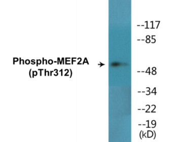 Phospho-MEF2A (Thr312) Colorimetric Cell-Based ELISA Kit