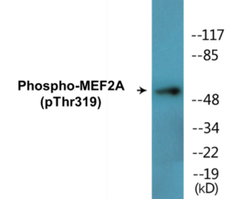 Phospho-MEF2A (Thr319) Colorimetric Cell-Based ELISA Kit