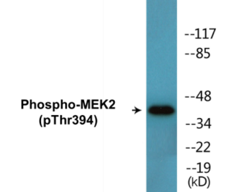 Phospho-MEK2 (Thr394) Colorimetric Cell-Based ELISA Kit