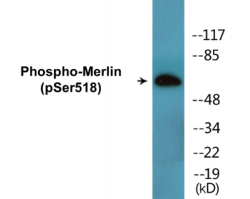 Phospho-Merlin (Ser518) Colorimetric Cell-Based ELISA Kit