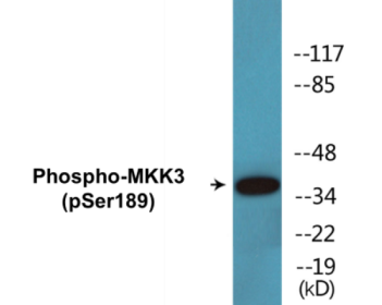 Phospho-MKK3 (Ser189) Colorimetric Cell-Based ELISA Kit