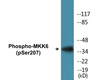 Phospho-MKK6 (Ser207) Colorimetric Cell-Based ELISA Kit