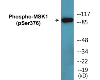 Phospho-MSK1 (Ser376) Colorimetric Cell-Based ELISA Kit