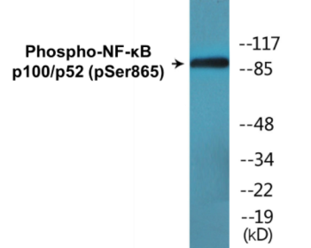 Phospho-NF-κB p100/p52 (Ser865) Colorimetric Cell-Based ELISA Kit