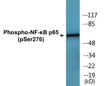 Phospho-NF-κB p65 (Ser276) Colorimetric Cell-Based ELISA Kit