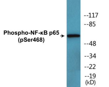 Phospho-NF-κB p65 (Ser468) Colorimetric Cell-Based ELISA Kit