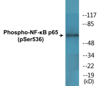 Phospho-NF-κB p65 (Ser536) Colorimetric Cell-Based ELISA Kit