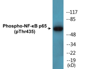 Phospho-NF-κB p65 (Thr435) Colorimetric Cell-Based ELISA Kit