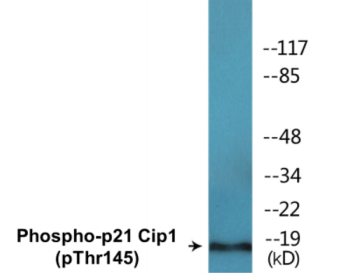 Phospho-p21 Cip1 (Thr145) Colorimetric Cell-Based ELISA Kit