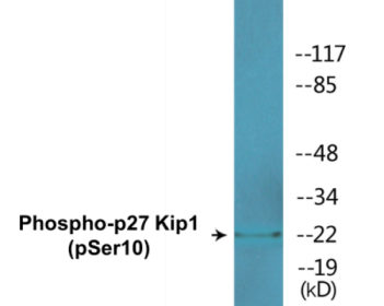 Phospho-p27 Kip1 (Ser10) Colorimetric Cell-Based ELISA Kit