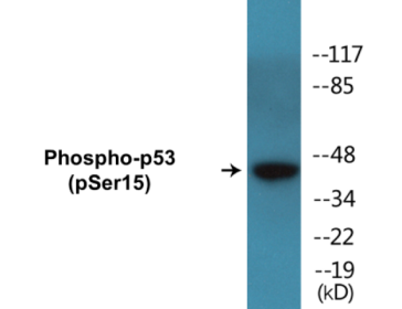 Phospho-p53 (Ser15) Colorimetric Cell-Based ELISA Kit