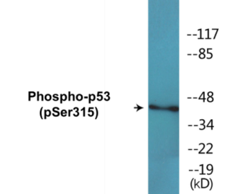Phospho-p53 (Ser315) Colorimetric Cell-Based ELISA Kit