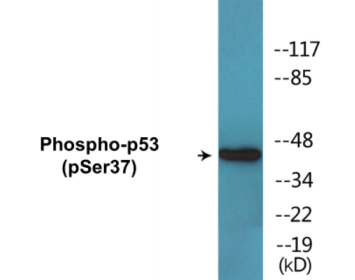 Phospho-p53 (Ser37) Colorimetric Cell-Based ELISA Kit