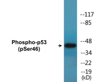 Phospho-p53 (Ser46) Colorimetric Cell-Based ELISA Kit