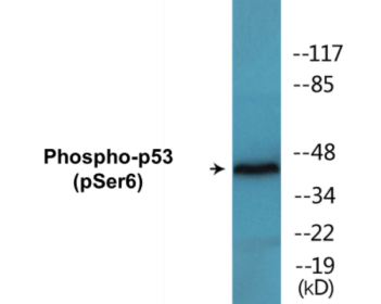 Phospho-p53 (Ser6) Colorimetric Cell-Based ELISA Kit