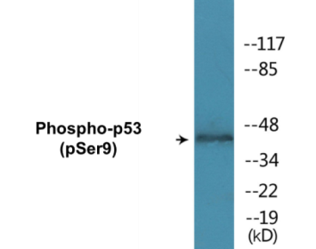 Phospho-p53 (Ser9) Colorimetric Cell-Based ELISA Kit