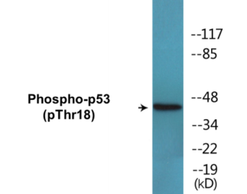 Phospho-p53 (Thr18) Colorimetric Cell-Based ELISA Kit