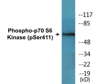 Phospho-p70 S6 Kinase (Ser411) Colorimetric Cell-Based ELISA Kit