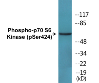 Phospho-p70 S6 Kinase (Ser424) Colorimetric Cell-Based ELISA Kit