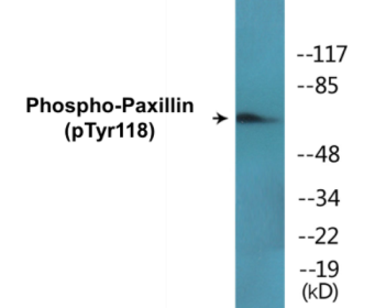 Phospho-Paxillin (Tyr118) Colorimetric Cell-Based ELISA Kit