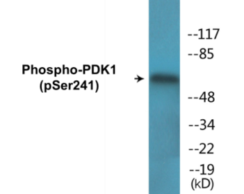 Phospho-PDK1 (Ser241) Colorimetric Cell-Based ELISA Kit