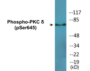Phospho-PKC delta (Ser645) Colorimetric Cell-Based ELISA Kit