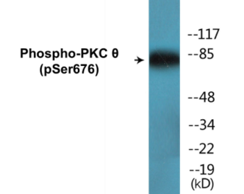 Phospho-PKC theta (Ser676) Colorimetric Cell-Based ELISA Kit