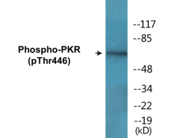 Phospho-PKR (Thr446) Colorimetric Cell-Based ELISA Kit