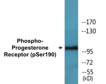 Phospho-Progesterone Receptor (Ser190) Colorimetric Cell-Based ELISA Kit