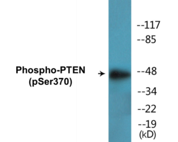 Phospho-PTEN (Ser370) Colorimetric Cell-Based ELISA Kit